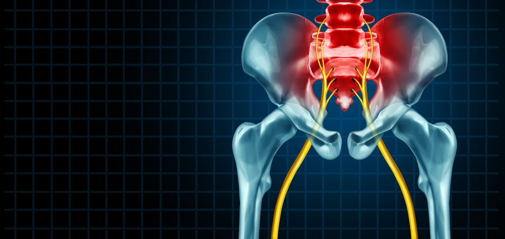 Is it Sciatica or Piriformis Syndrome? - Cold Spring Chiropractic